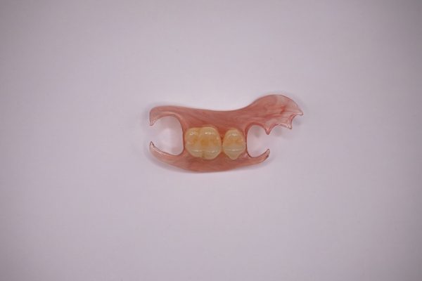 Nesbit flexible partial for one or two missing teeth